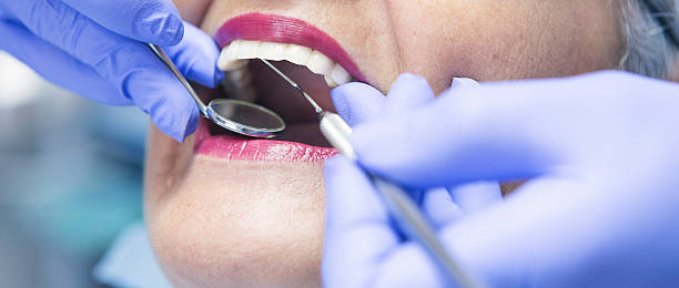 Best Emergency Cosmetic Dentistry (e.g., broken veneers) in Marengo, IA